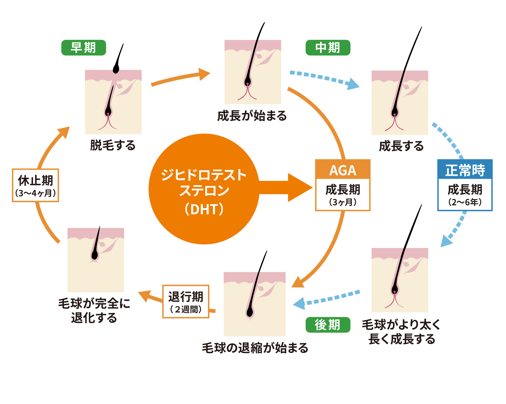 ジヒドロテストステロン（DHT）