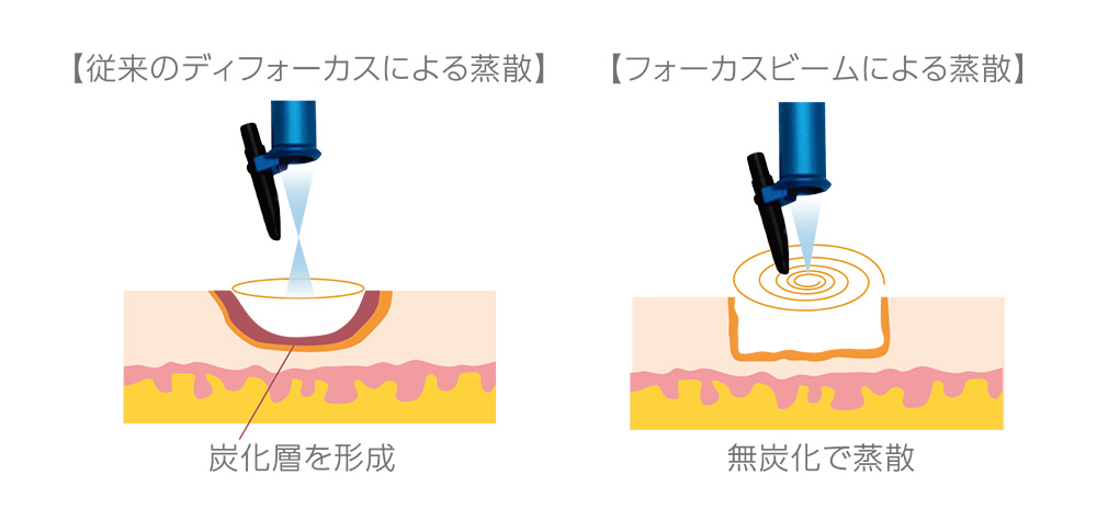 特徴①色素沈着が少ない　イメージ