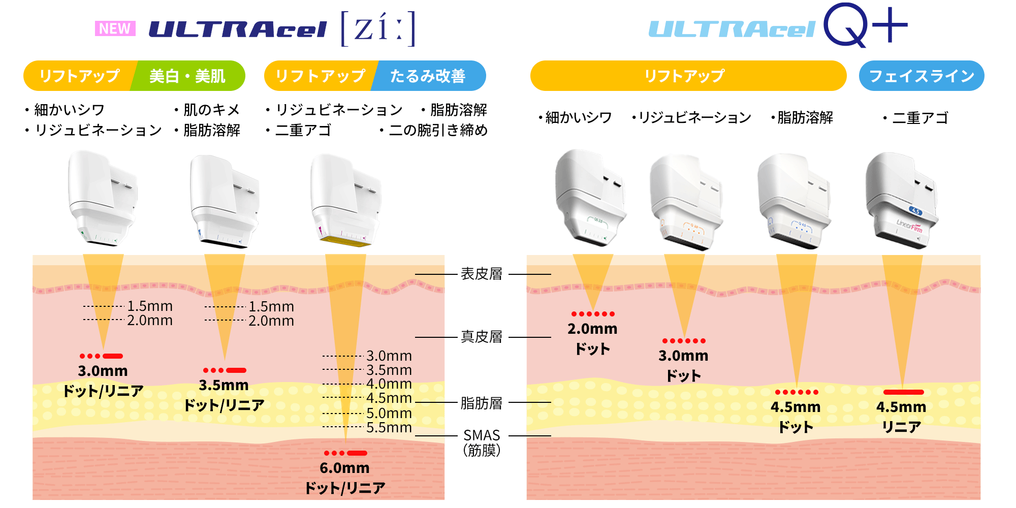 従来のハイフ機器とウルトラセルZiの違い