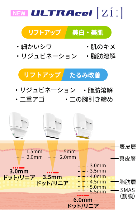 従来のハイフ機器とウルトラセルZiの違い