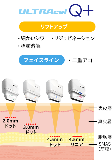 従来のハイフ機器とウルトラセルZiの違い