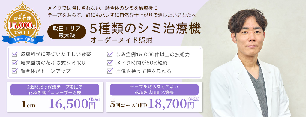 シミ取り