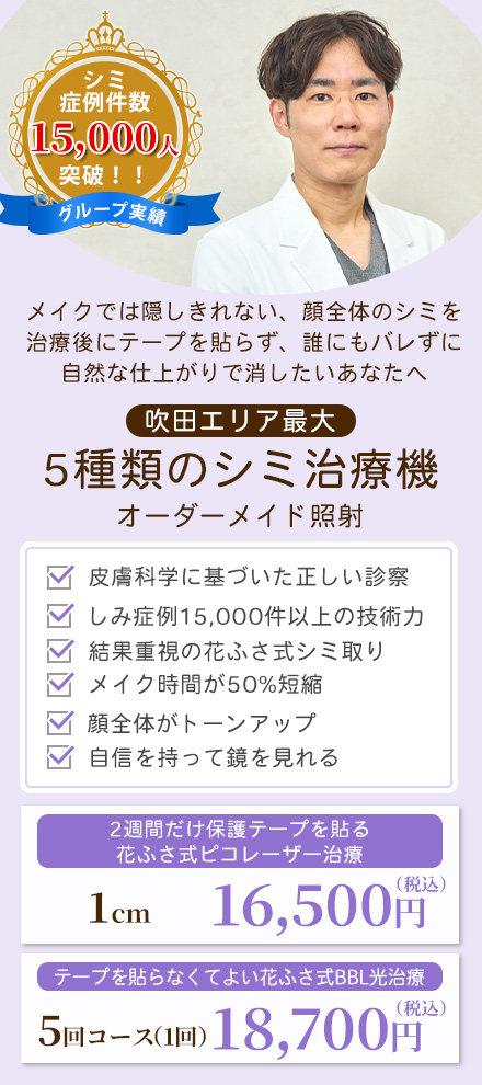 シミ取り