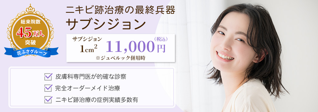 サブシジョン