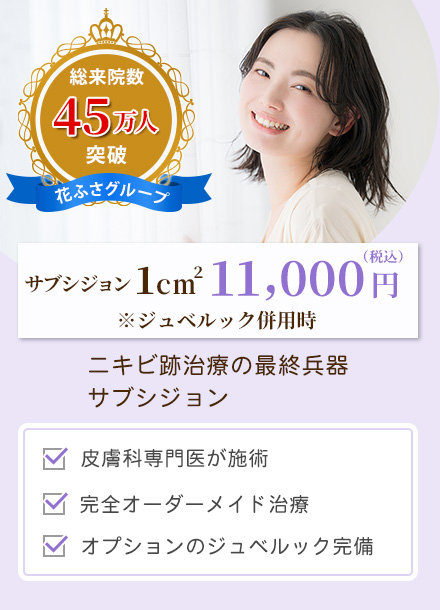 サブシジョン