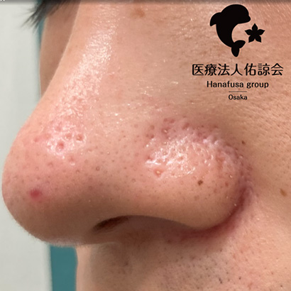 施術前
