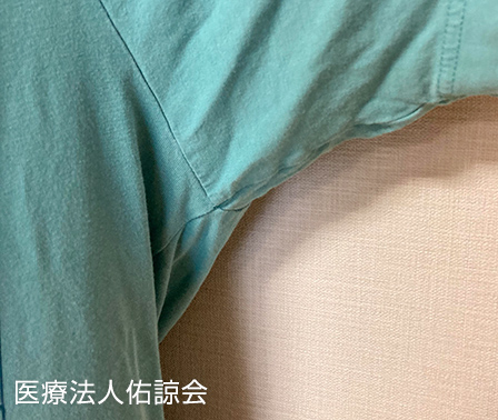 ミラドライ施術後