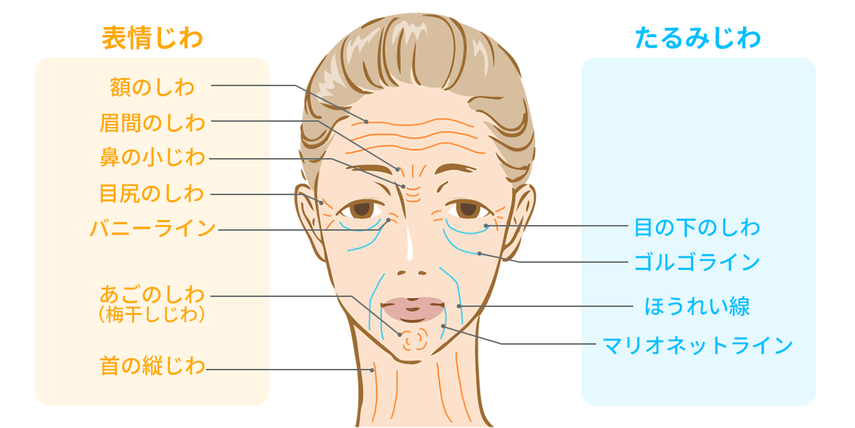 しわ治療