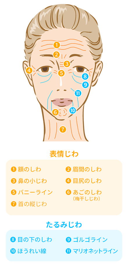 しわ治療