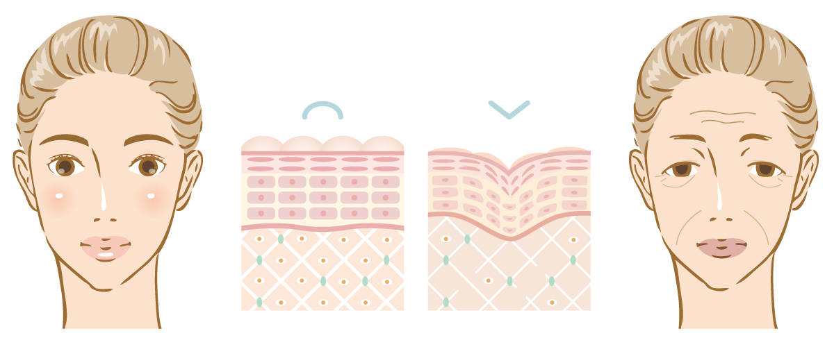 シワ・たるみの原因　イメージ