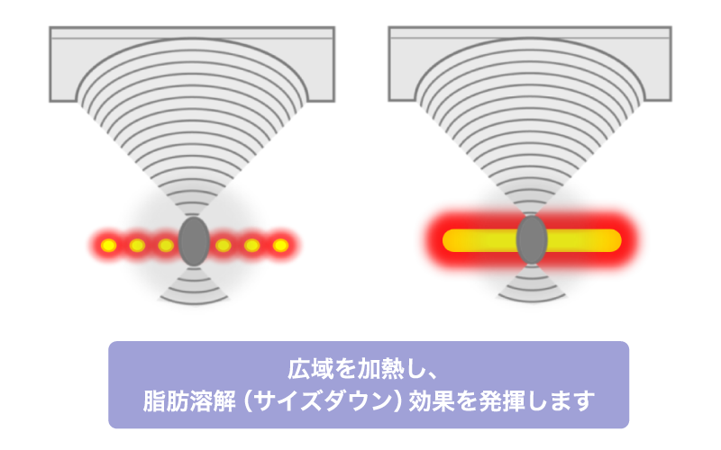 小顔効果を発揮するリニアモードを搭載　イメージ