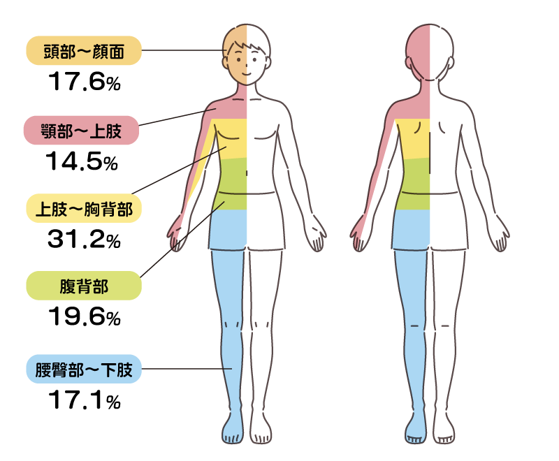 原因