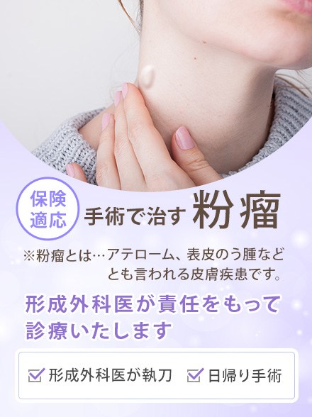粉瘤手術