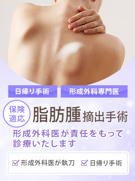 脂肪腫摘出手術
