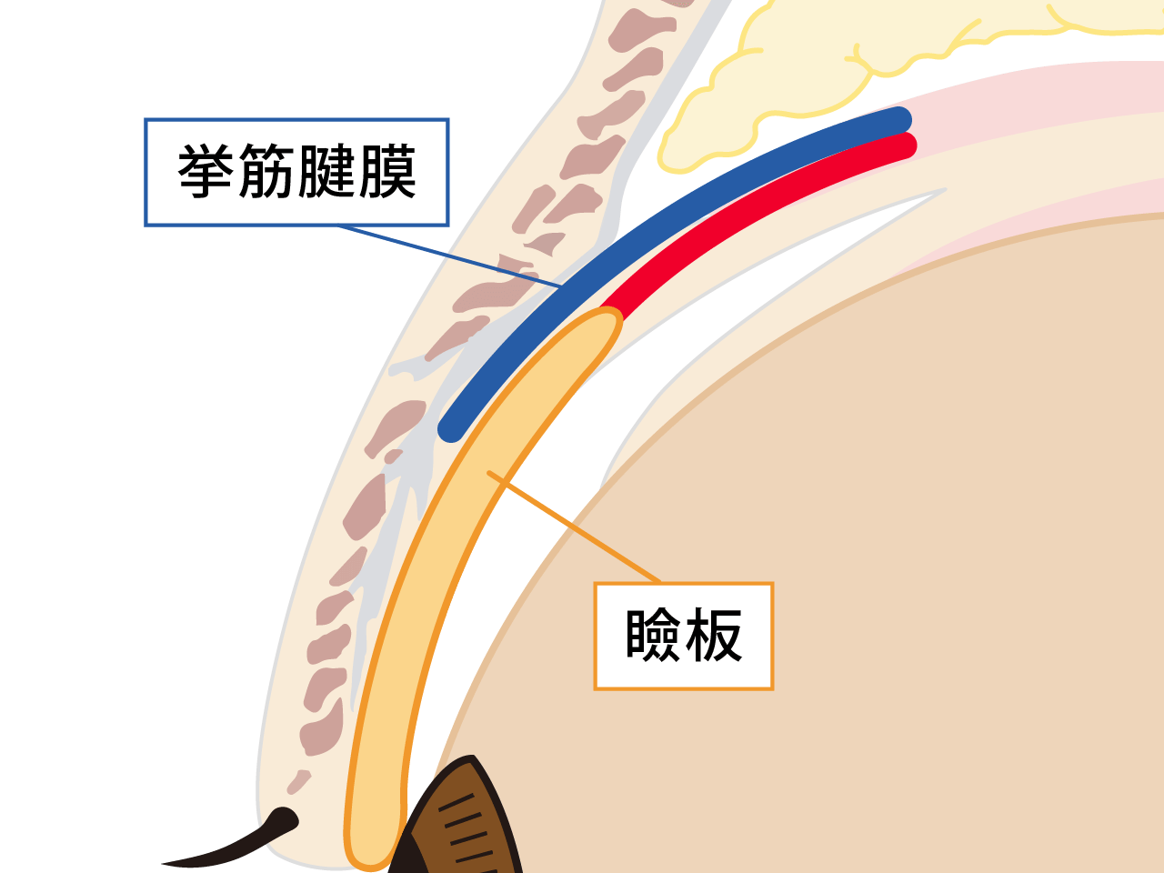 眼瞼下垂の治療①　イメージ