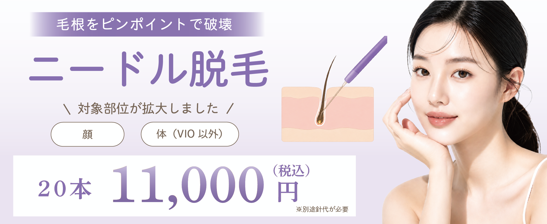 ニードル脱毛キャンペーン