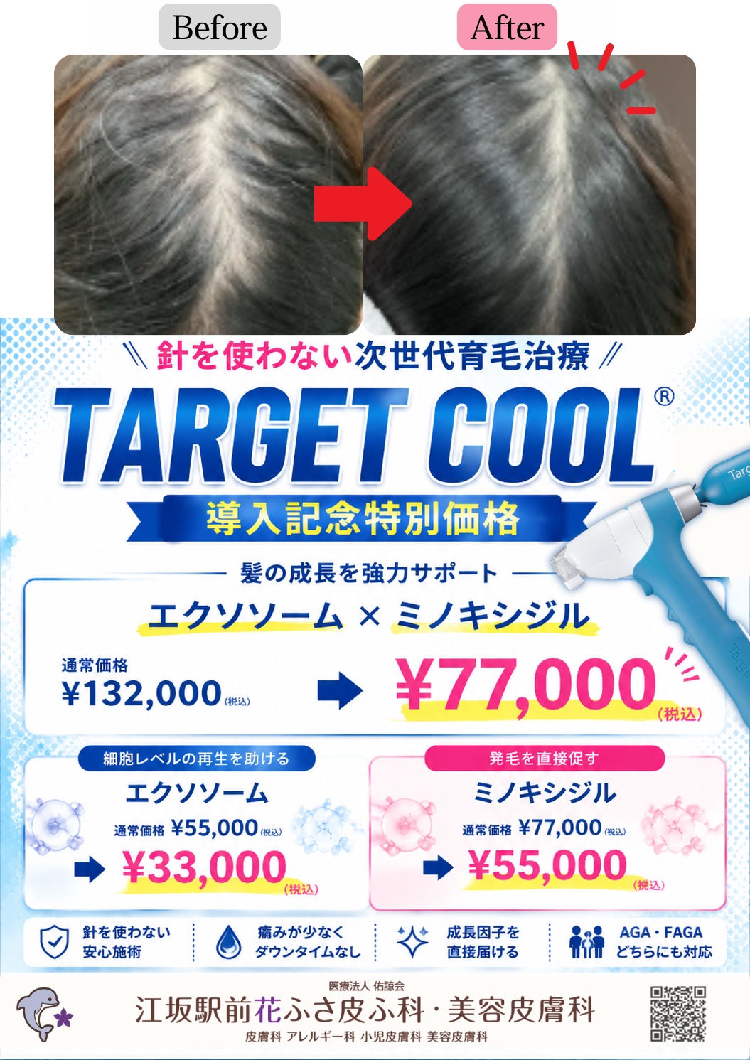 ターゲットクールAGAFAGA